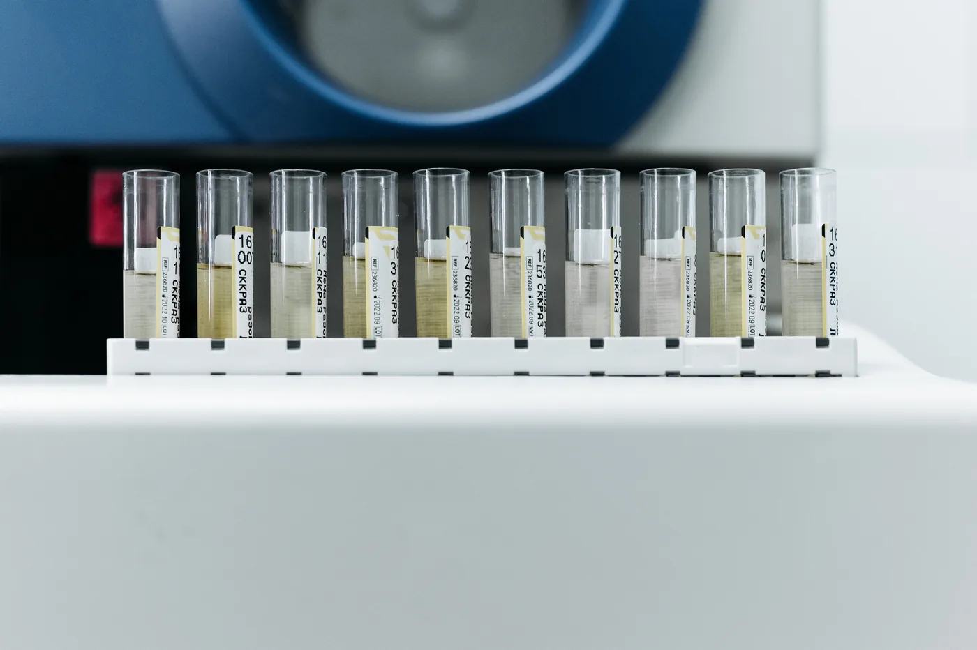 Réduire nitrates et contaminants de l&rsquo;eau domestique